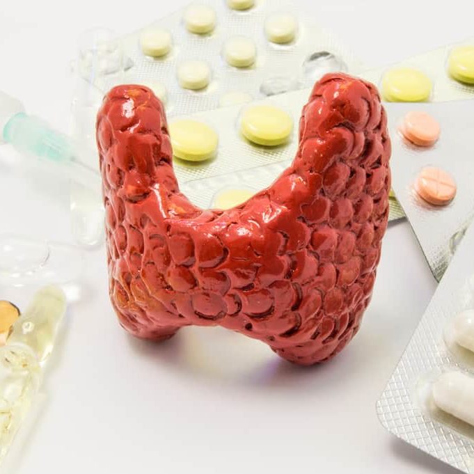 Hypothyroidism